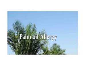 Palm oil Allergy