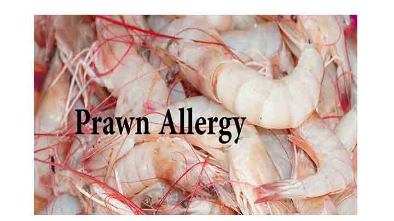 Prawn Allergy Symptoms Treatment Management Allergy Cure