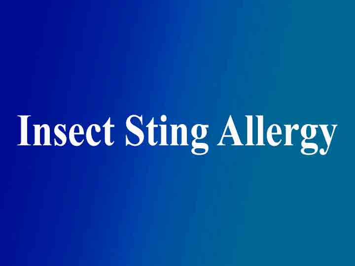 Insect Sting Allergy