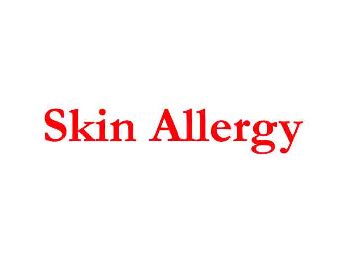 Skin Allergy